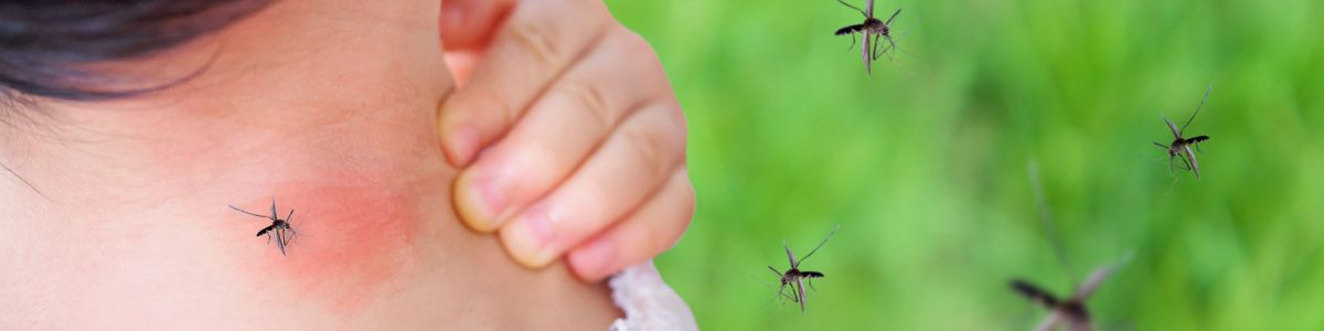 Cet été, les moustiques n'auront pas sa peau ! Nos conseils et ...